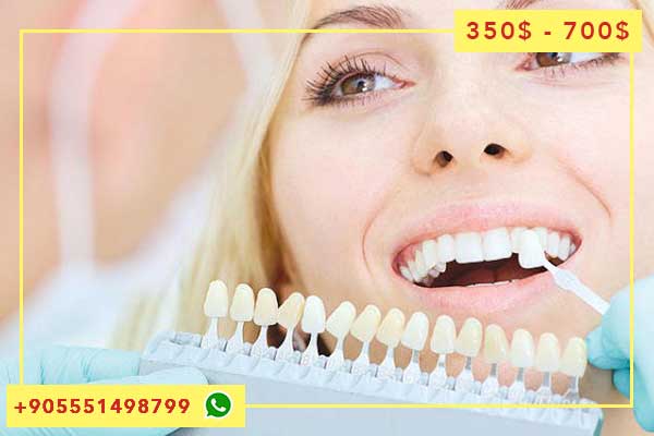 Cost and prices of a Hollywood smile in Türkiye Istanbul (Hollywood smile)