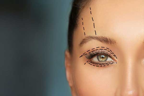Eyelid surgery cost in Türkiye