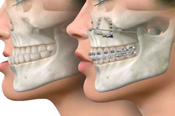 Mund-, Kiefer- und Gesichtschirurgie