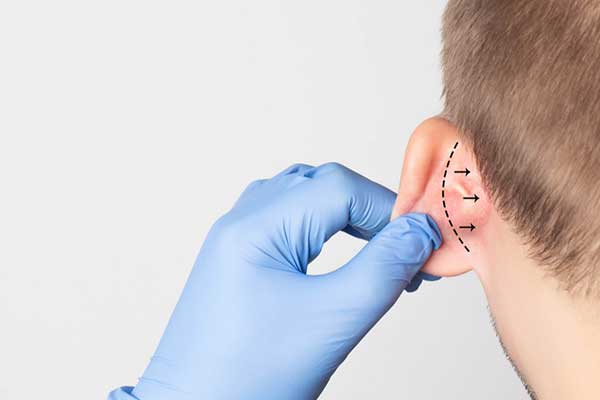 عملية تجميل الأذن بالليزر – إزالة العيوب واستعادة الثقة