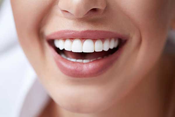 تلبيسة أسنان جاهزة في الصيدلية – مميزات و عيوب و طرق التركيب