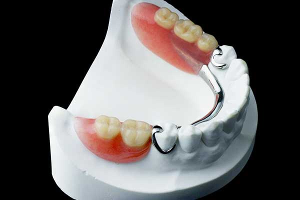 أنواع أطقم الأسنان التجميلية