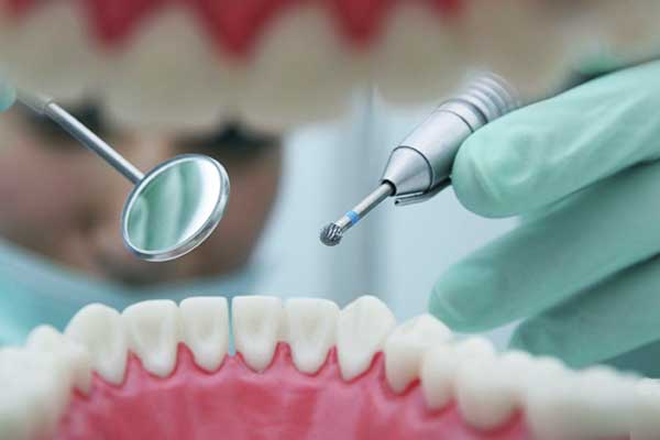 أسعار تصليح الأسنان في تركيا: دليلك الشامل للعناية بصحة فمك