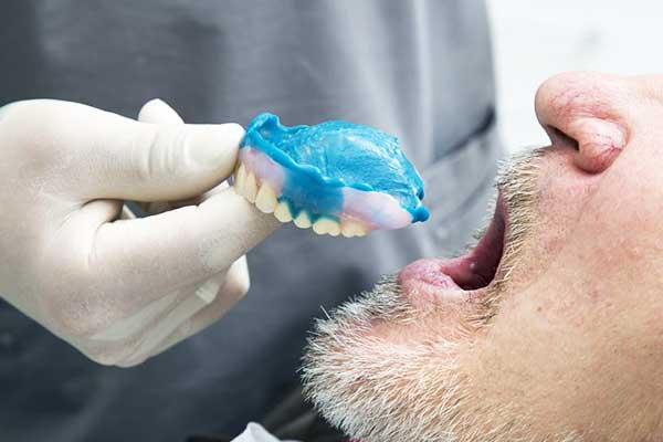 تجربتي مع طقم الأسنان: رحلة إلى الابتسامة المثالية