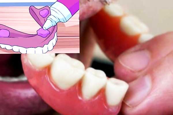 طريقة لصق طقم الأسنان: دليل شامل لتحقيق الثبات والراحة