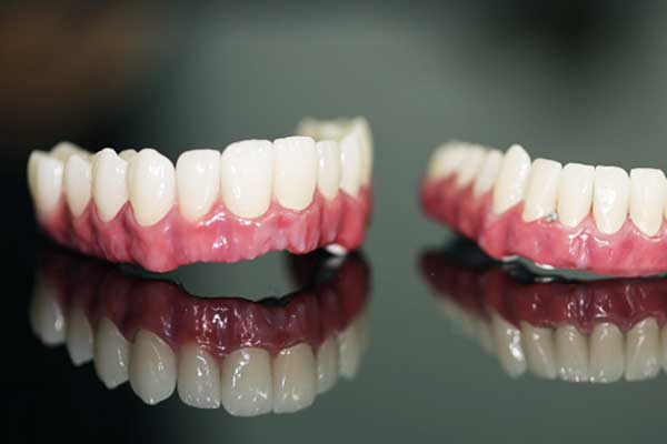 كم تكلفة طقم الأسنان المتحرك: دليل شامل لتكاليف الأطقم المتحركة