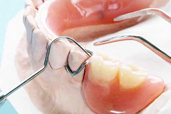 مشاكل طقم الأسنان المتحرك: الأسباب والحلول